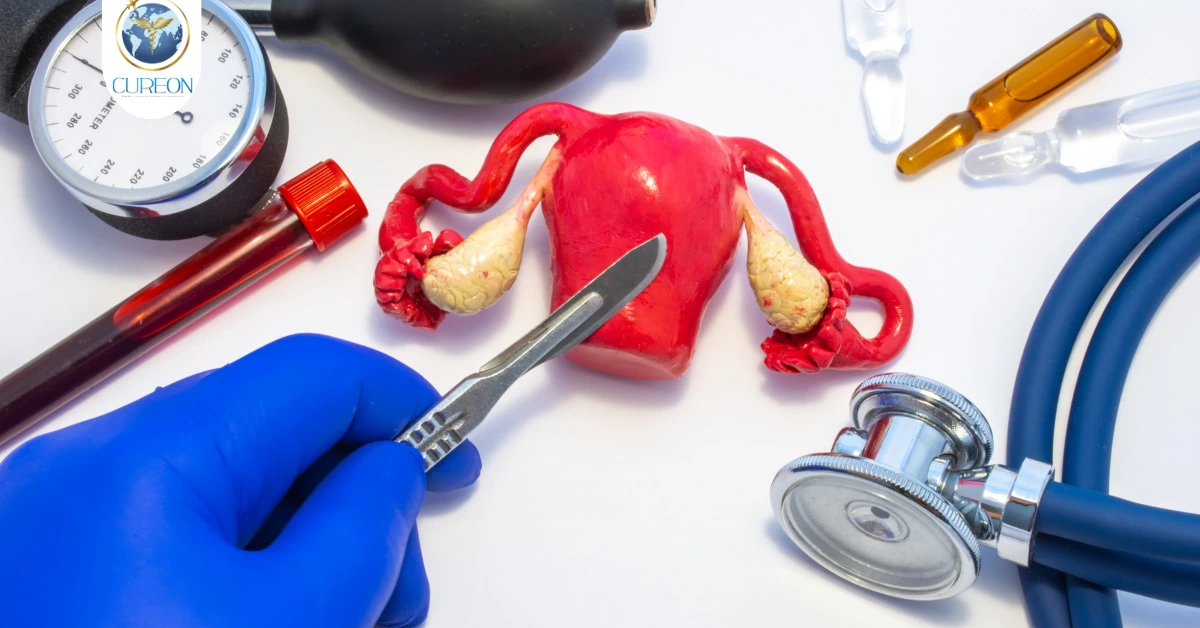 Hysterectomy in Indore: Best Treatment Through Cureon Medical Tourism-extra-1