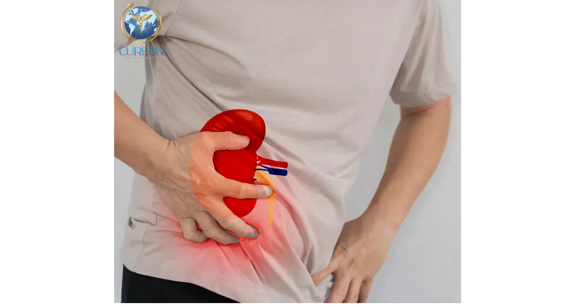 RIRS vs PCNL for Kidney Stones: Which Procedure Is Used for Which Stone? -extra-1