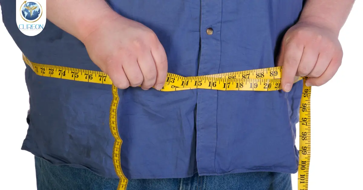 Affordable Weight Loss Surgery in India: Cost & Procedures-extra-1