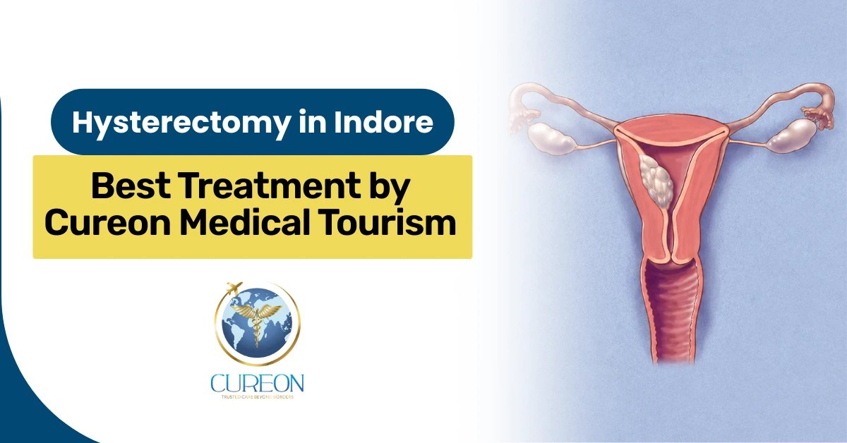 Hysterectomy in Indore: Best Treatment Through Cureon Medical Tourism