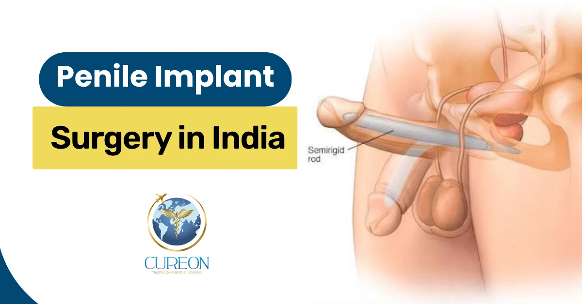 Penile Implant Surgery in India