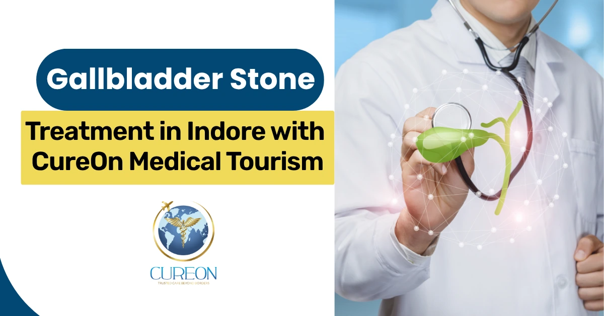 Best Gallbladder Stone Treatment in Indore with CureOn Medical Tourism