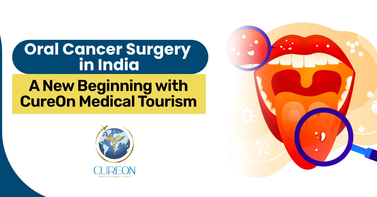 Oral Cancer Surgery in India: A New Beginning with CureOn Medical Tourism