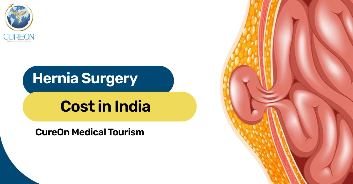 Hernia Surgery Cost in India