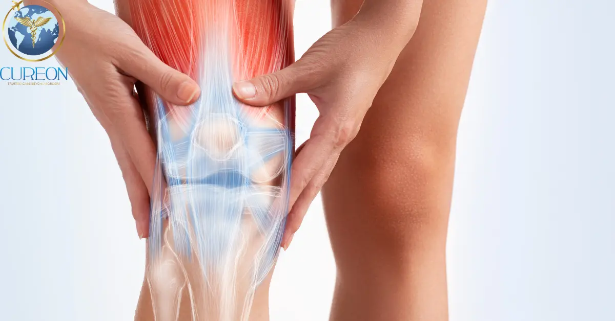 Revision Knee Replacement Surgery in Indore-extra-1