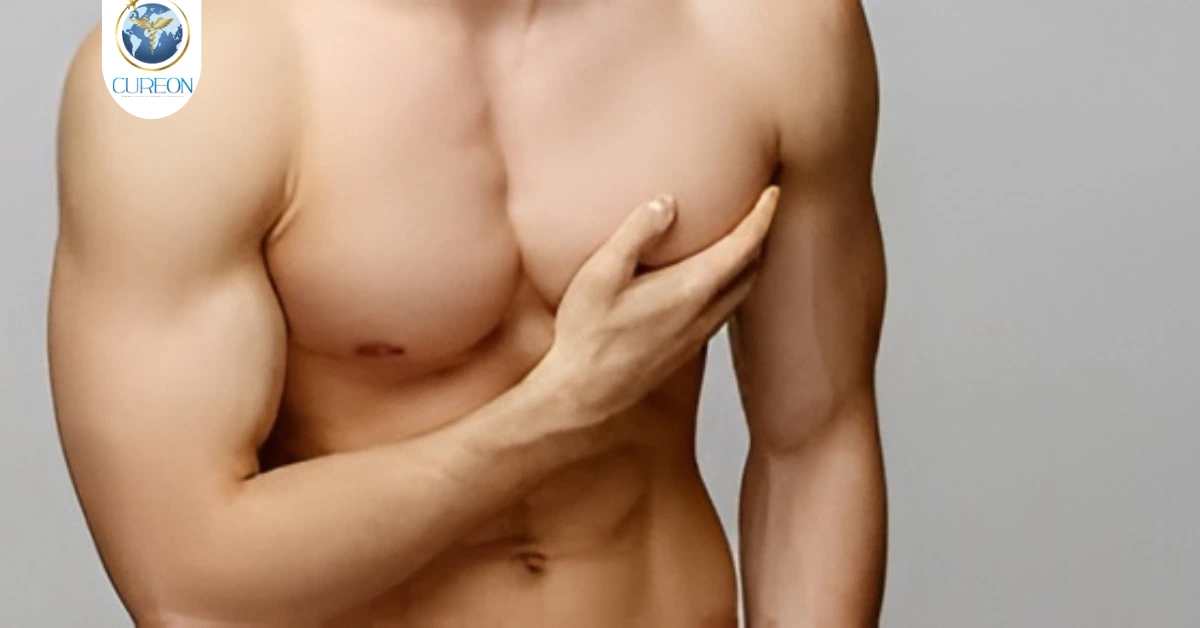 Gynecomastia Treatment in India: Safe and Effective Male Breast Reduction Surgery-extra-1