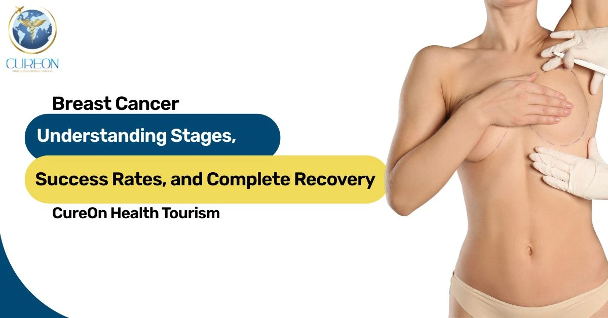 Breast Cancer: Understanding Stages, Success Rates and Complete Recovery