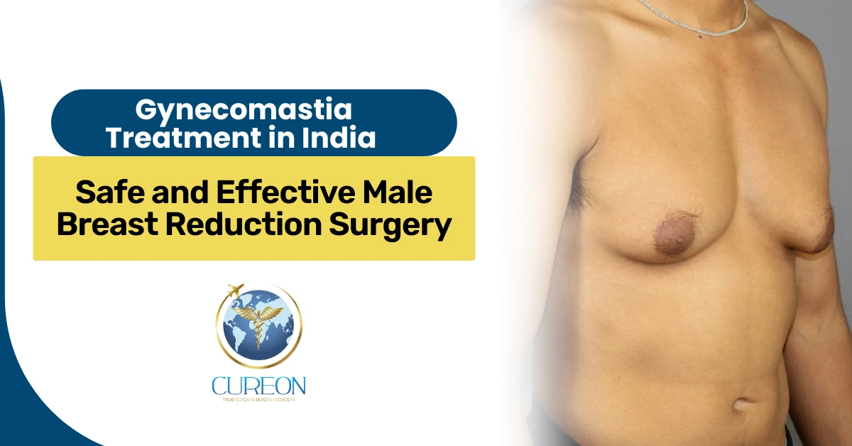 Gynecomastia Treatment in India: Safe and Effective Male Breast Reduction Surgery
