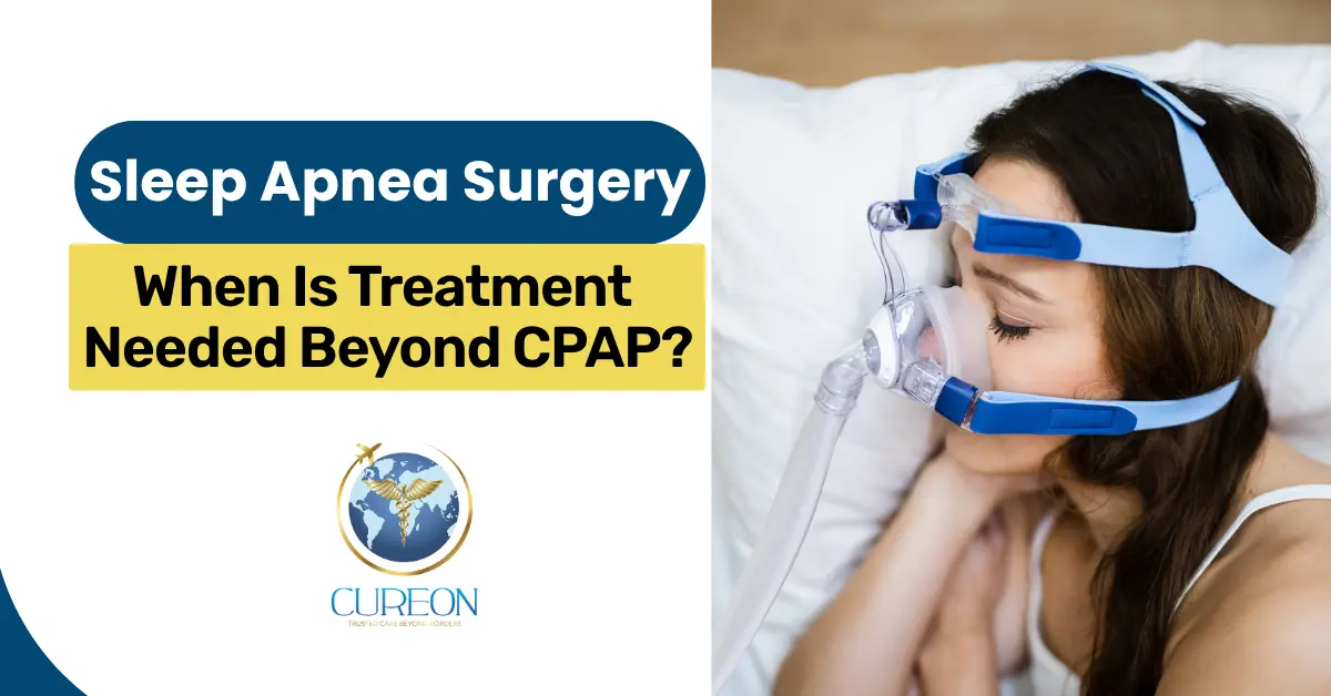 Sleep Apnea Surgery: When Is Treatment Needed Beyond CPAP?