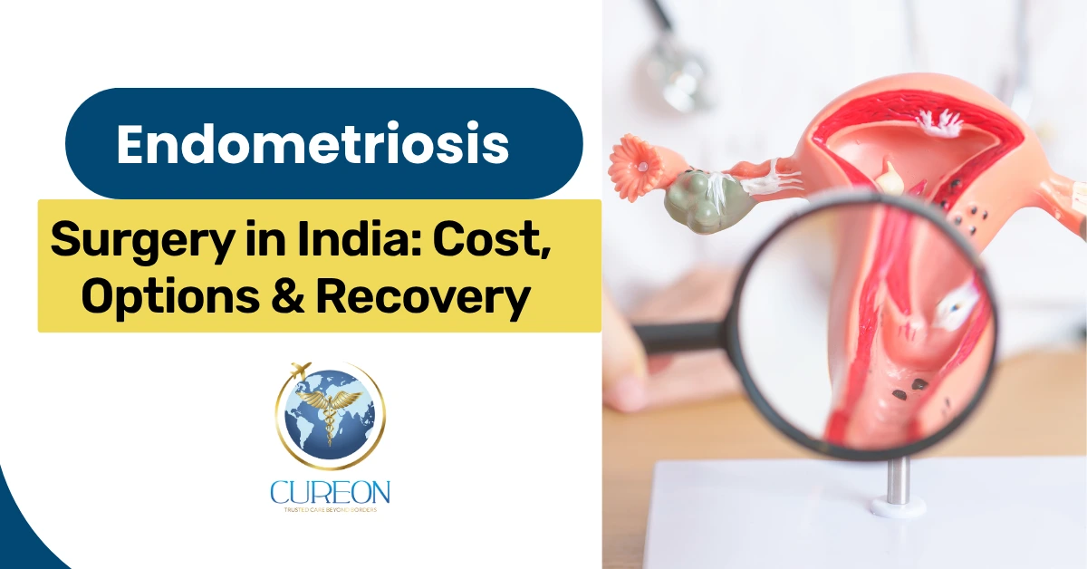 Endometriosis Surgery in India: Cost, Options & Recovery