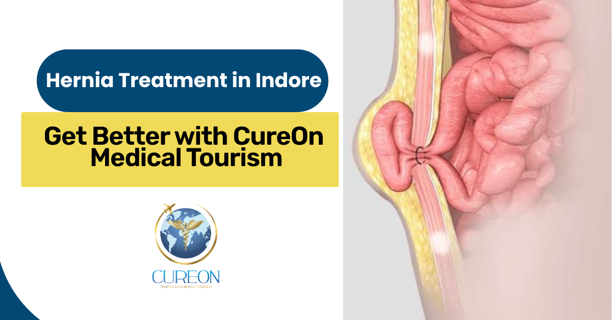 Hernia Treatment in Indore