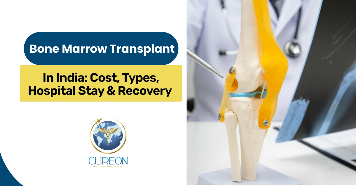 Bone Marrow Transplant in India: Cost, Types, Hospital Stay & Recovery