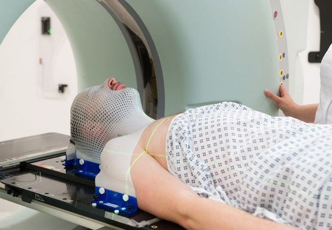 Palliative Radiation Therapy