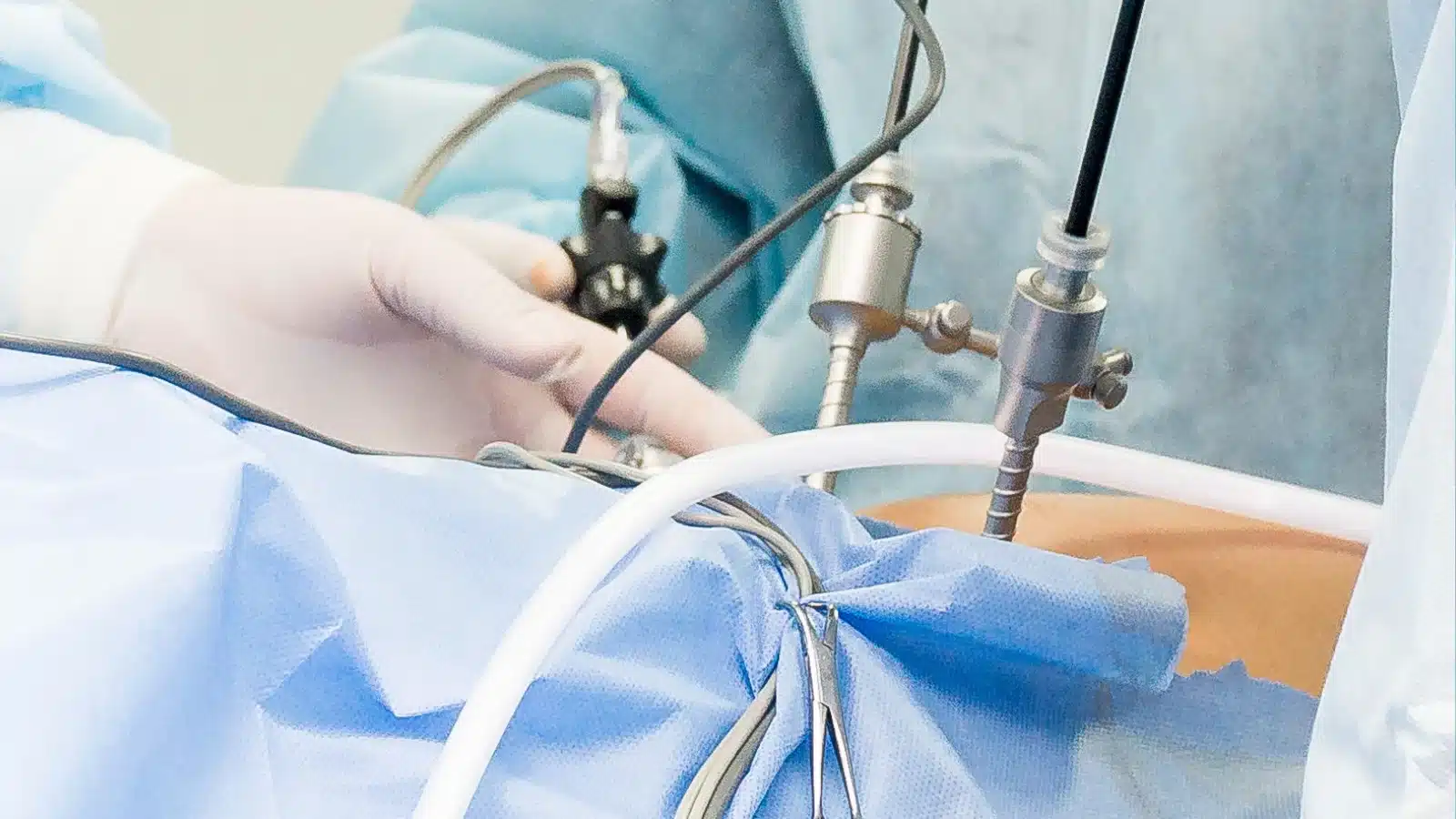 Hernia Laparoscopic