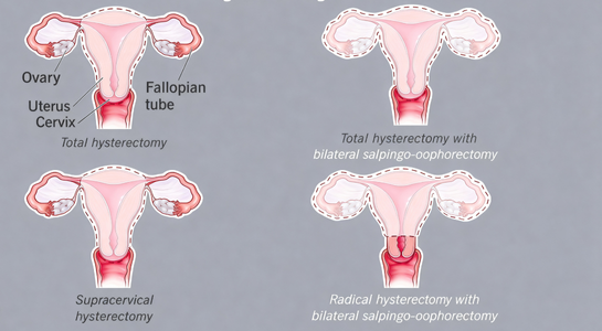 Vaginoplasty