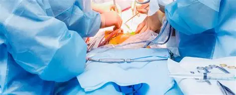 Stricture Urethra Surgery (Urethroplasty)
