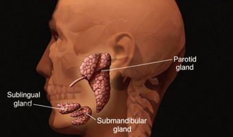 Parotid Surgery