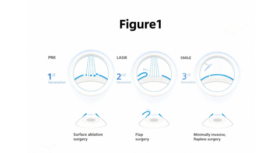 LASIK PRP(Pan-Retinal Photocoagulation)
