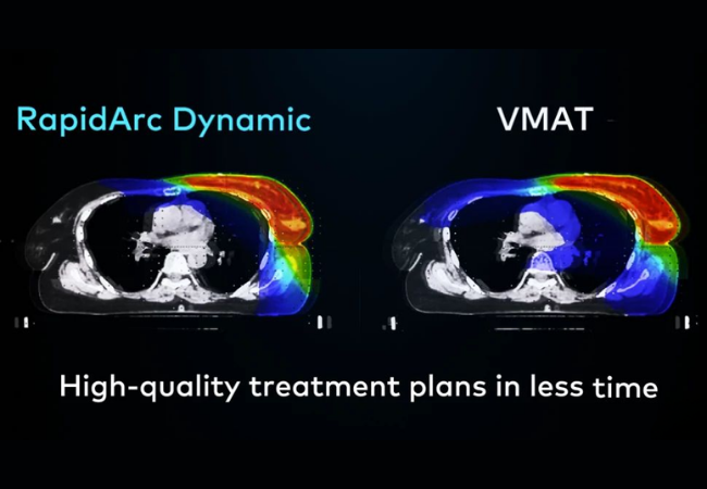 Rapid Arc / VMAT(Volumetric Modulated Arc Therapy)